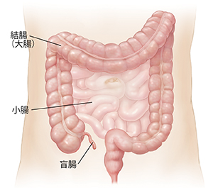 小腸と結腸を示す腹部の略図。