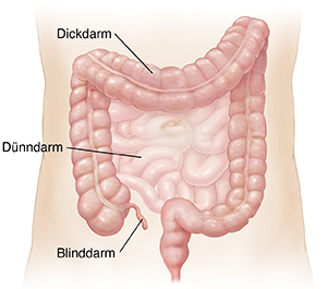 Schematische Darstellung des Bauchs mit Dünn- und Dickdarm