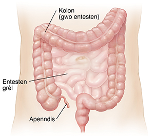 Viwonn abdomèn nan k ap montre entesten grèl la ak kolon an.