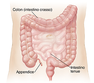 Profilo di un addome con intestino tenue e colon in evidenza.