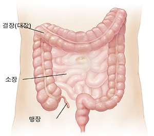 소장과 결장이 보이는 복부의 대략적 모습.