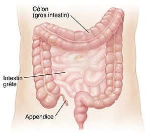 Schéma de l'abdomen montrant l'intestin grêle et le côlon.